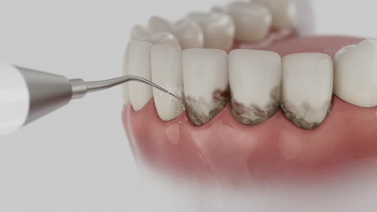 Reliable Dental Implants contractor in Davison, MI by Smile Center Dentistry